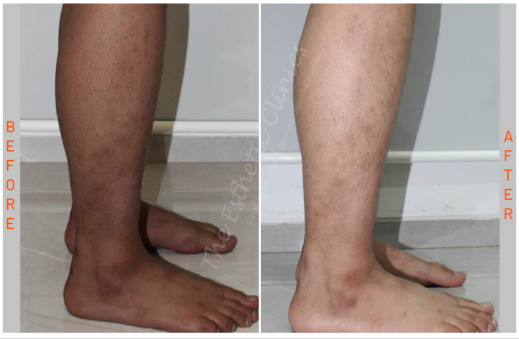 Esthetic Body Brite 